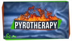 Pyrotherapy: An Awful Nobel Prize for Infecting People with Malaria Instructional Video