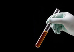 Catalizador Instructional Video