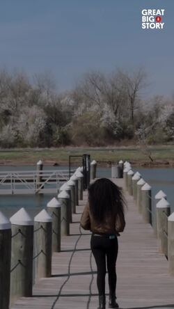 Shalom Blac's inspiring journey, embracing beauty beyond scars Instructional Video