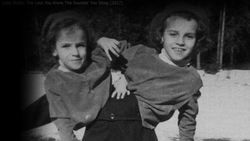 How Conjoined Twins Ended Up Taking Very Different Life Paths Instructional Video