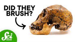 When Did We Start Getting Cavities? Instructional Video