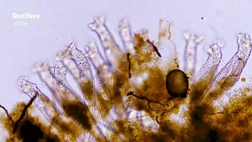 Rotifers Charmingly Bizarre & Often Ignored