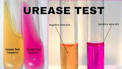 Urea Hydrolysis (Urease) Test Instructional Video