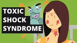 What is Toxic Shock Syndrome? (Tampons Disease) Instructional Video