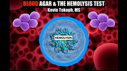 Blood Agar | The Hemolysis Test [Theory & Results] Instructional Video