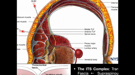 The IST Complex & Stabilization of the Spine