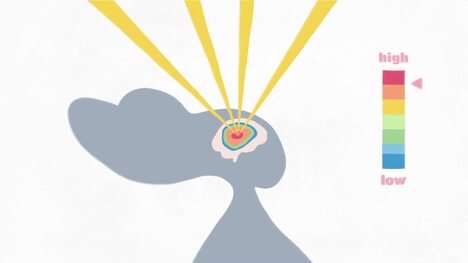 TED-Ed: Performing brain surgery without a scalpel | Hyunsoo Joshua No