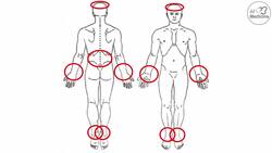 Lichen Planus (“Purple Skin Lesions”) | Causes, Signs & Symptoms, Diagnosis, Treatment Instructional Video