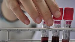 Blood test laboratory equipment Stock Footage