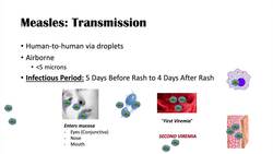 Introduction to Measles | Causes, Risk Factors, Transmission, Stages of Infection, Signs & Symptoms Instructional Video