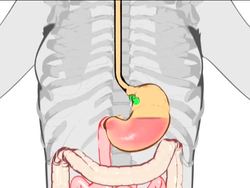 Healthy Digestive and Excretory Systems: Summing Up Instructional Video