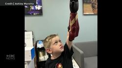 #TheMoment a 5-year-old achieved superhero status with new bionic arm News Clip