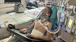 Innovative surgery could restore some mobility for paralyzed Ontario teen News Clip