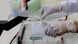 Gel Electrophoresis Instructional Video