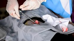 Vet doing the operation for sterilization. The cat on the operating table in a local clinic. Cat in a veterinary surgery , Stock Footage