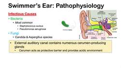 Swimmer’s Ear (Otitis Externa) | Risk Factors, Causes, Signs & Symptoms, Diagnosis, Treatment Instructional Video