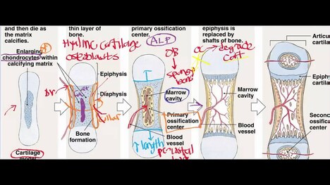 Endochondral Ossification