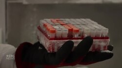 How a Montreal hospital uses AI to predict heart problems News Clip