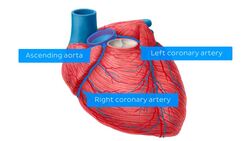 Clinical case: Long ectopic left main coronary artery Instructional Video