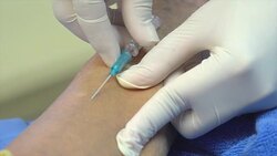 CU nurse makes a venipuncture Stock Footage