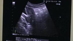 Ultrasonography machine. High technology medical and healthcare equipment. Ultrasound imaging or sonography used in medicine. Film Ultrasound, Internal organs examination for women Stock Footage