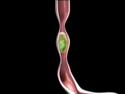 Exploring the Digestive and Excretory Systems: Video Assessment Instructional Video
