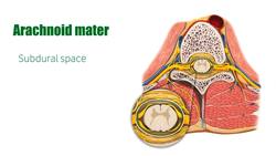 Arachnoid mater Instructional Video