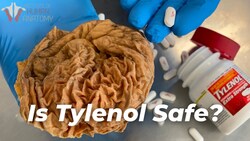 Understanding Tylenol and How it Works in the Body Instructional Video