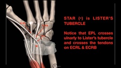 Wrist Extensor Zones EXPLAINED Instructional Video