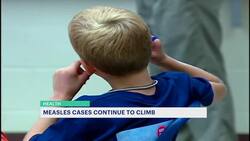 CDC: Measles could lose 'elimination status' amid uptick across the U.S. News Clip