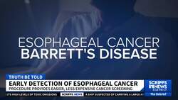 Procedure to provide less expensive screening for esophageal cancer News Clip