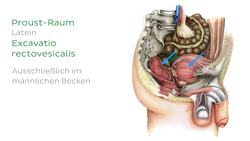 Excavatio rectovesicalis Instructional Video