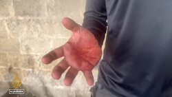 Israeli forces kill American-Turkish activist in the occupied West Bank News Clip