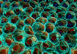 Cholesterol Instructional Video