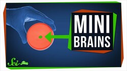 What Growing Mini Brains Has Taught Us, And What's Next Instructional Video