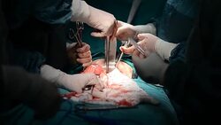Hysterectomy Surgery Stock Footage