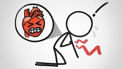 Why Do Heart Attacks Cause *Arm* Pain? Instructional Video