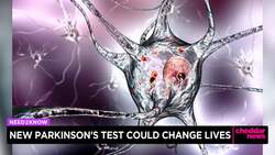 New Parkinson's Lab Test Could Change Lives News Clip