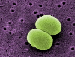 Vida microscópica: bacteria Instructional Video