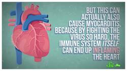 Why Athletes Are Worried About COVID: Its Toll on the Heart Instructional Video
