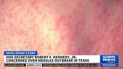 RFK Jr. calls measles outbreak a 'call to action,' urges people get vaccinated News Clip