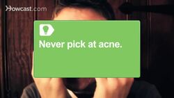 How to Get Rid of Acne Scars Instructional Video