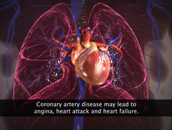 Disorders of the Circulatory System Instructional Video
