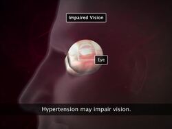 Disorders of the Circulatory System Instructional Video