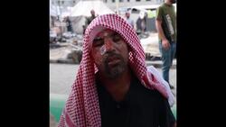 Palestinian man burned alive after Israeli strike on hospital courtyard Instructional Video