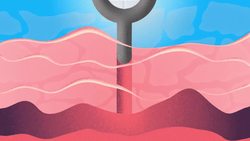 TED-Ed: What causes opioid addiction, and why is it so tough to combat? Instructional Video