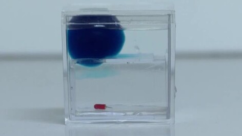 CLEAN : California start-up sending tiny robots on fantastic voyage into brains
