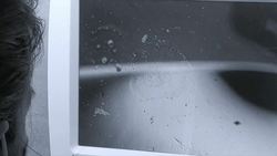 TED: Could you recover from illness ... using your own stem cells? | Nabiha Saklayen Instructional Video