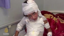 Gaza's burn patients suffer as Israel's blockade chokes crucial medical supplies News Clip