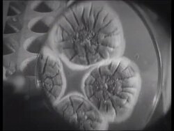 Penicillin and the Iron Lung, 1928 Stock Footage